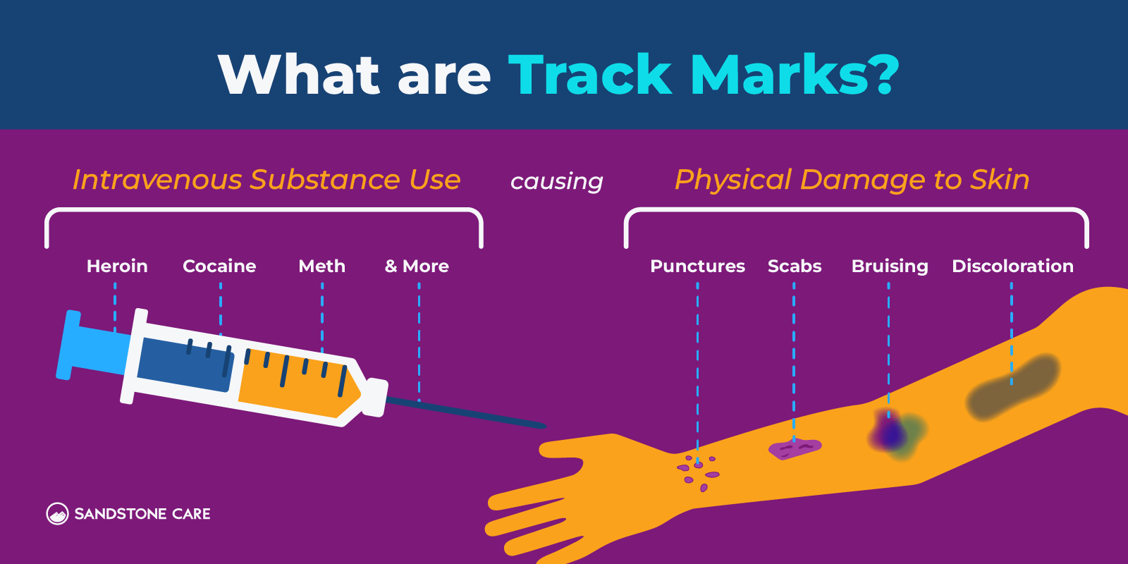 Heroin Drug 06 What Are Track Marks And What Do They Look Like Explained Inline Image