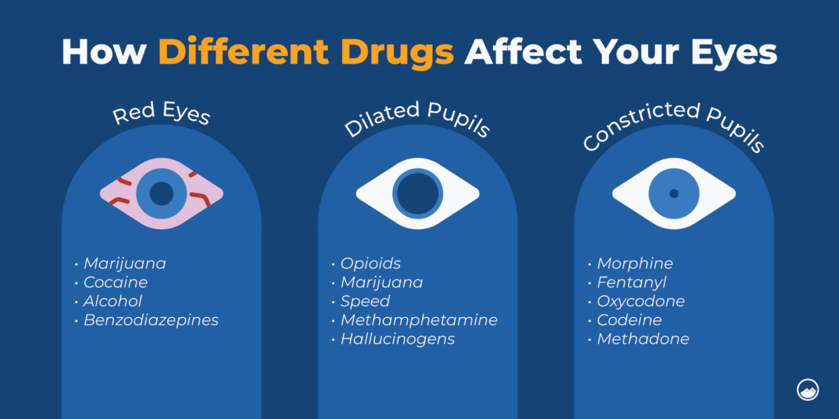 High Eyes: Causes, Symptoms & How to Fix Them