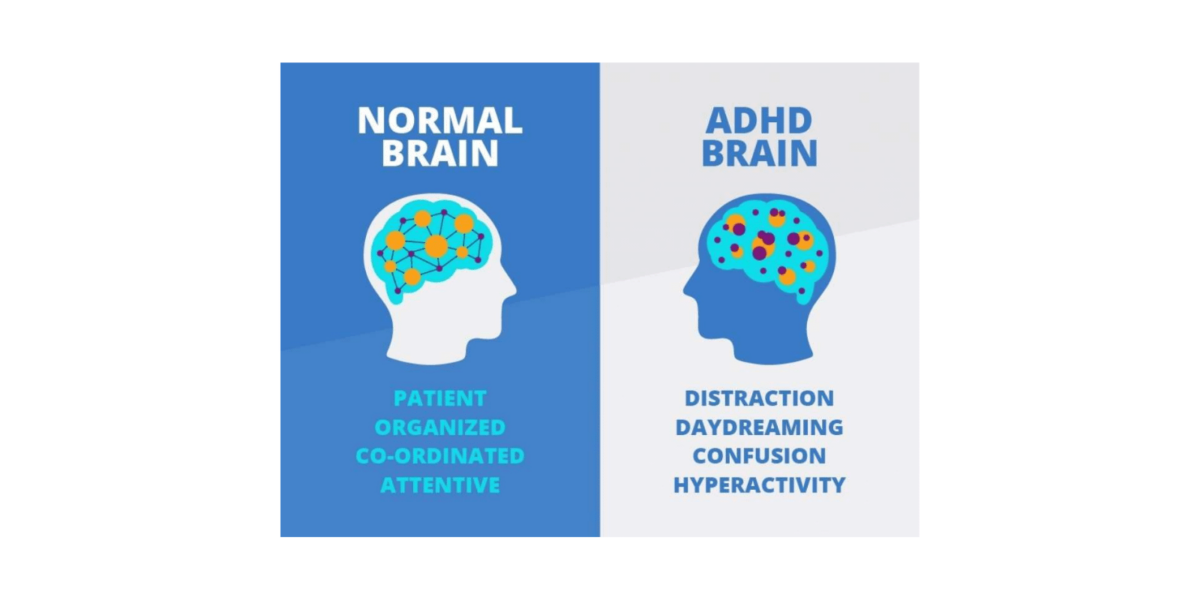 Teens & ADHD - Co-occurring Disorders | Sandstone Care