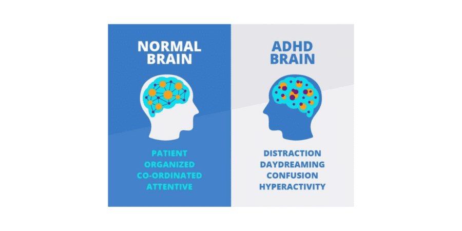 Teens & ADHD - Co-occurring Disorders | Sandstone Care